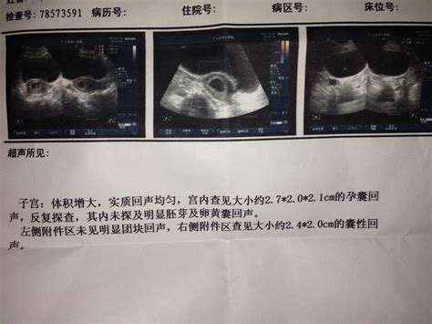 我媳妇怀孕三个月了，昨天去医院检查，胎儿各项发育正常，想问B超上的红色和蓝色是什么意思？ - 百度宝宝知道