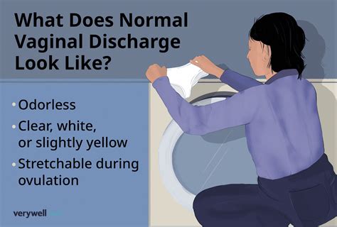 Normal Vaginal Discharge 的图像结果