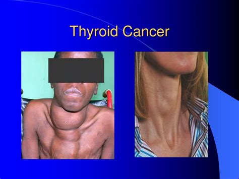 Image result for Thyroid Function Algorithm