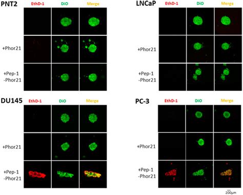Targeting of the Interleukin-13 Receptor (IL-13R)α2 Expressing Prostate ...