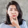Bell's Palsy - patofisiologi, diagnosis, penatalaksanaan - Alomedika