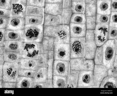 Microscope Images Of Plant Cells