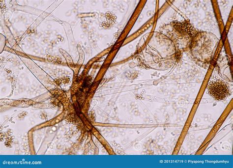 Rhizopus Under Compound Microscope