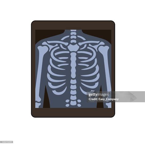 X Ray Cartoon Cute Radiologist Doctor Holding X Ray Rontgen