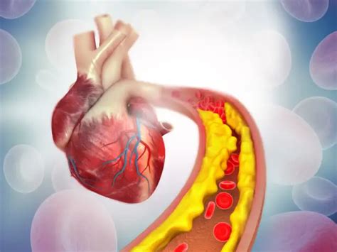 30-day cholesterol challenge: 6 simple yet powerful steps to lower ...