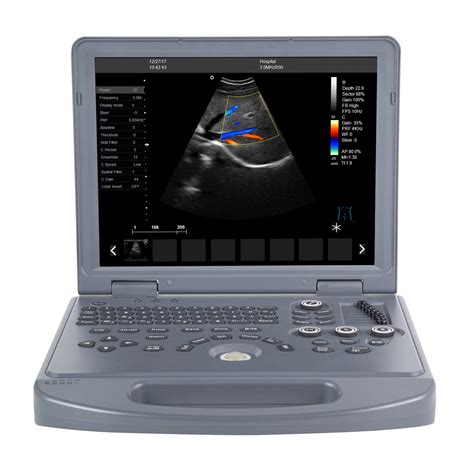 Fy-L3 Latest Portable and USG System Price Ultrasound Scan Machine - Ultrasound Scanner and ...