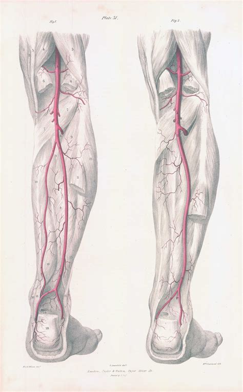 Vascular Calves