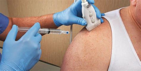 Image result for Fluoro Guided Injection