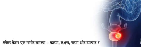 कोलोरेक्टल कैंसर: लक्षण, कारण और उपचार | Medtalks