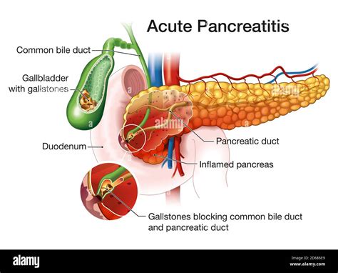 Pancreatic Enzymes Gallbladder at Rodolfo Freeman blog