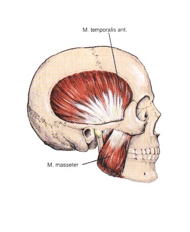 Image result for Masseter Muscle Trigger Point
