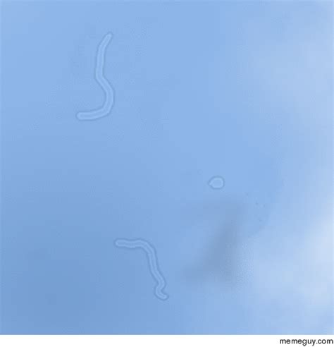 Image result for Eye Floaters Meme