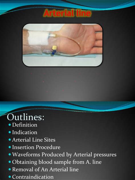 Image result for Arterial Line Procedure Note Template