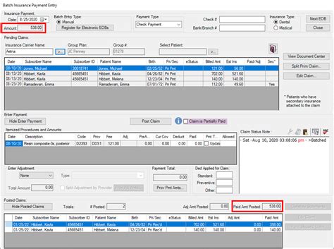 How to Enter Insurance Information Using Dentrix 的图像结果