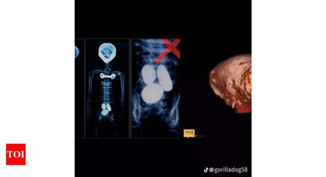 Image result for Alien Inside Female Body