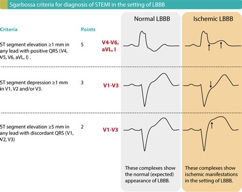 ST segment elevation in acute myocardial ischemia and differential ...