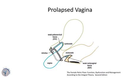 Pelvic anatomy in relation with pelvic organ prolapse | PDF