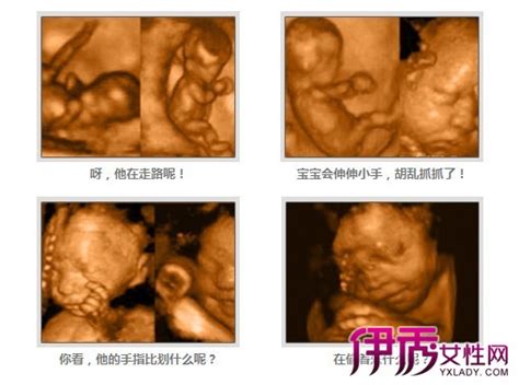 怀孕34周胎儿彩超图-_补肾参考网