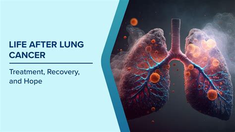 Lung Cancer Survivorship: Treatment, Recovery & Hope for Better Life ...