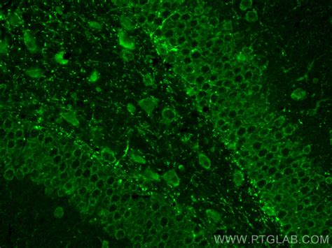 TRPM2 antibody (21842-1-AP) | Proteintech