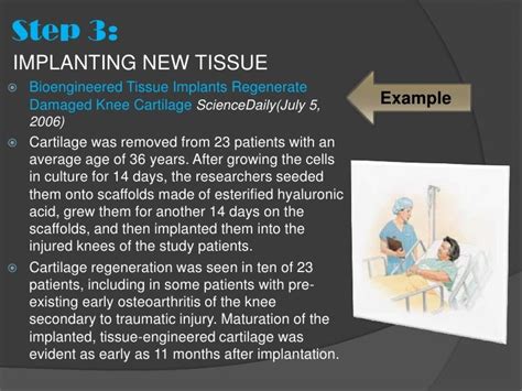 What Is Tissue Engineering 的图像结果