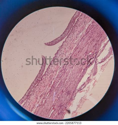 Image result for Tissue Sample Drawing Under Microscope