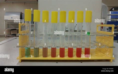 Image result for Benedict Test