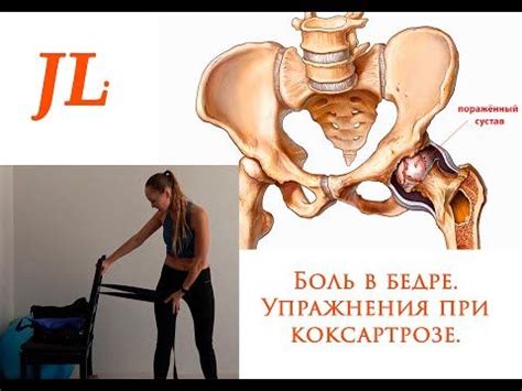 Упражнения при коксартрозе - YouTube | Упражнения, Фитнес-упражнения ...