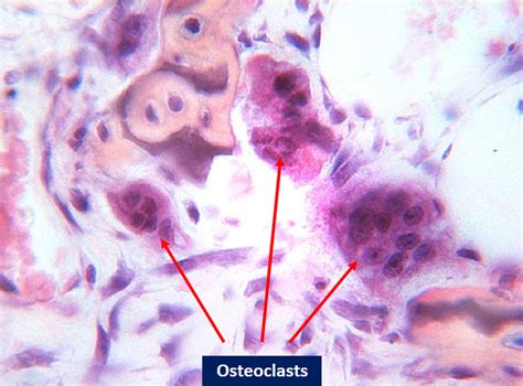 Development Of Osteoblasts And Osteoclasts From Bone