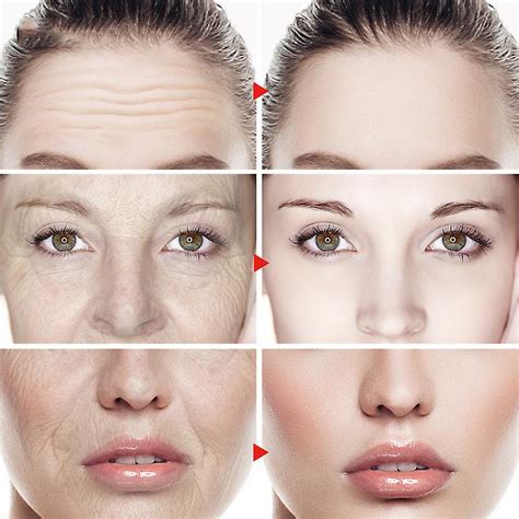 Buy Vova Remove Wrinkle Serum Collagen Lifting Firming Anti-Aging Face ...