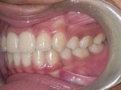 Gallery - PROFILE ORTHODONTICS & COSMETIC DENTISTRY