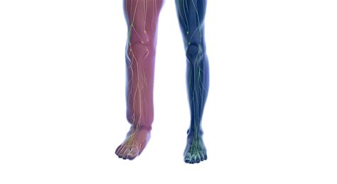 Best Vascular Surgeon in Secunderabad | Varicose Veins & PAD Treatment ...