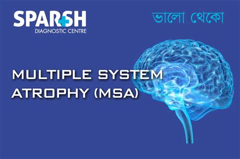 Multiple System Atrophy 的图像结果