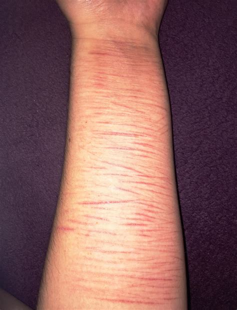 Do Cuts From Shaving Scar at Jesse Hernandez blog