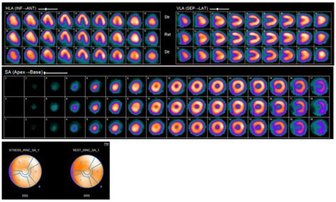 Cardiac Imaging in the Diagnosis and Management of Heart Failure