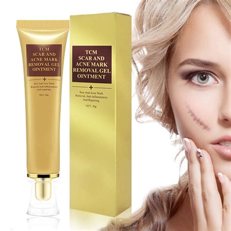 Buy Cream Gel , Acne Removal Cream, Fade Cream for Face and Body Treat ...