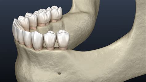 Tooth and Bone Loss in Pensacola, FL - Gum Disease | Dr. David Williams