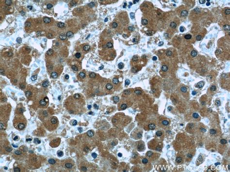 Clusterin antibody (66109-1-Ig) | Proteintech
