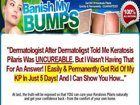 Keratosis pilaris cure | PPTX - what cures keratosis pilaris