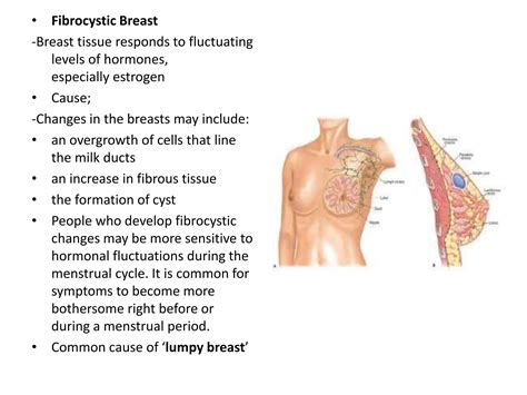Lecture 5- FEMALE BREAST ANATOMY FOR NURSING STUDENT 2-1.ppt