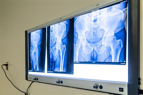 Bone tumors surgical treatment | ABC Medical Center