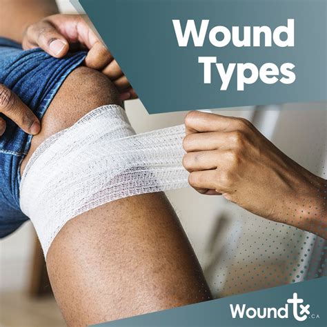 Wounds can be classified in three types: Primary Intention: It refers ...