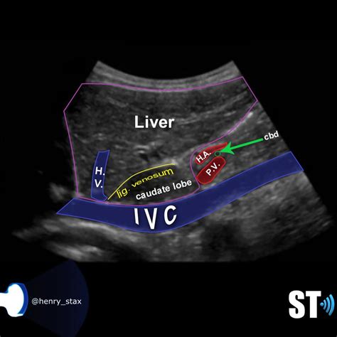 Pictures Of Liver Ultrasound
