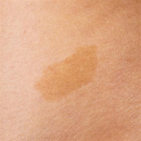 Where Do Skin Colors Come From? Melanin Science for Kids