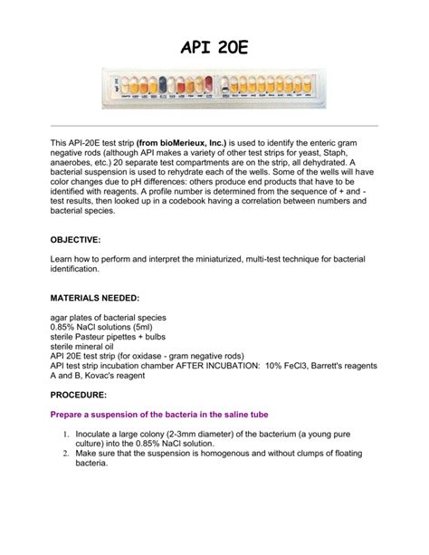 Image result for API 20E Identification Chart