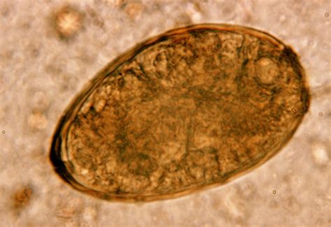 Feline Zoonosis | Encyclopedia MDPI