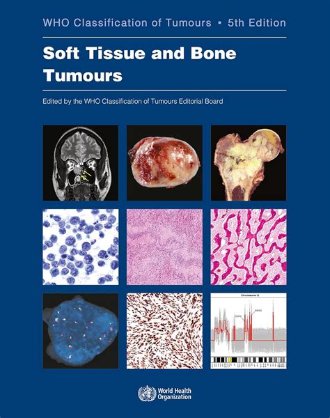 Buy WHO classification of tumours of soft tissue and bone tumours: 3 ...