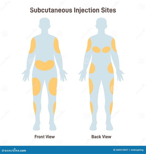 Image result for Injection Sites