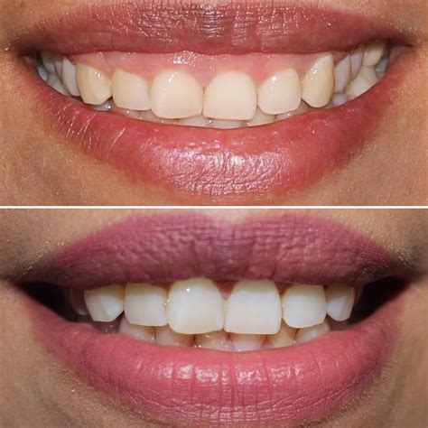 Dr. Andrés Gutiérrez - Especialista en Periodoncia e Implantología