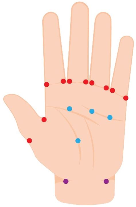 Botulinum Toxin Type A for the Treatment of Skin Ulcers: A Review Article